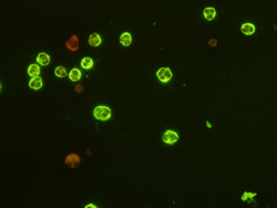 Antineutrophil Cytoplasmic Antibody